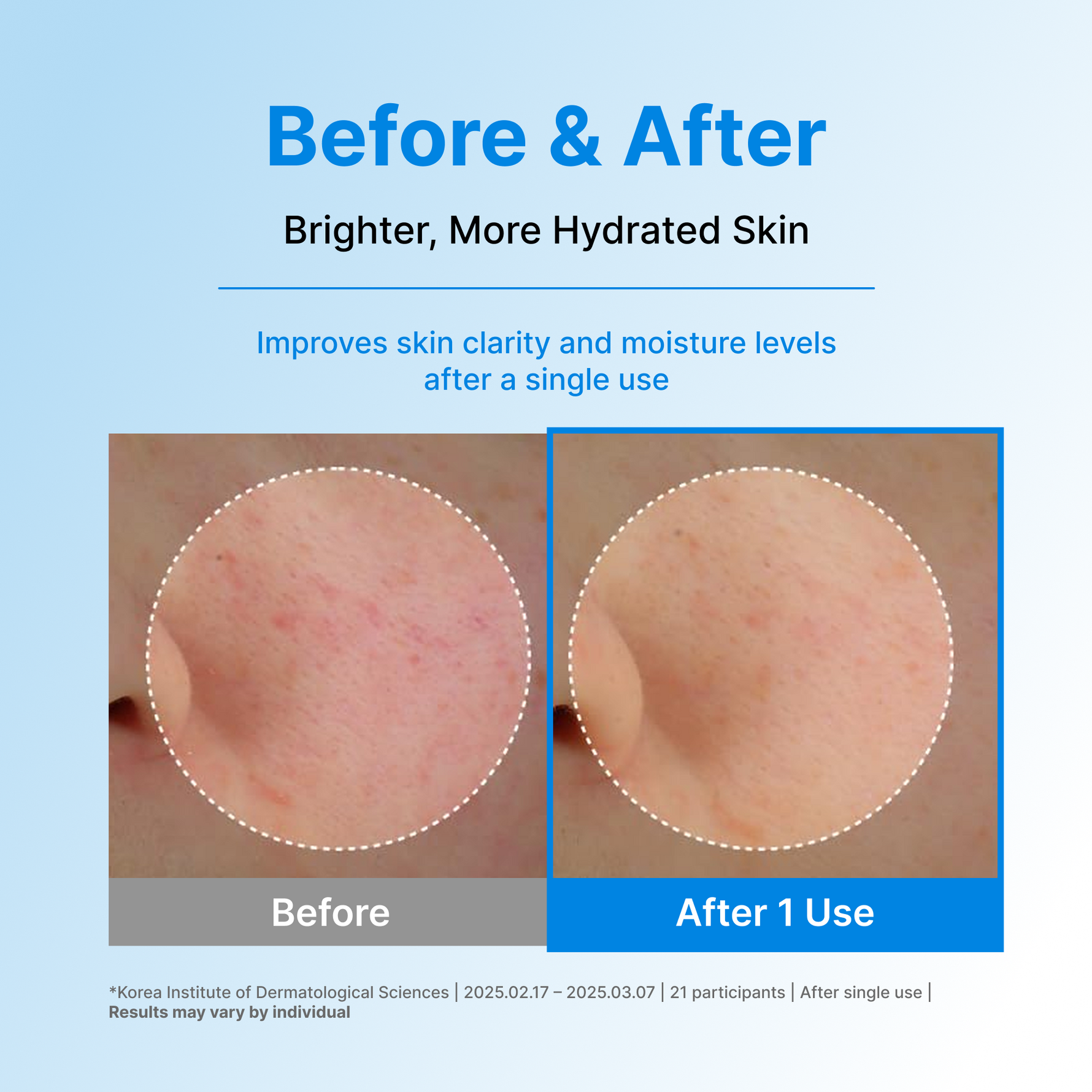 Madeca Lab HYAL Waterfull Glow Gel Mask – Centellian 24 Madeca Lab HYAL Waterfull Glow Gel Mask – Centellian 24